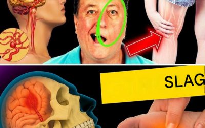 8 varseltegn på hjerneslag én måned før + 9 effektive tips for å forebygge det