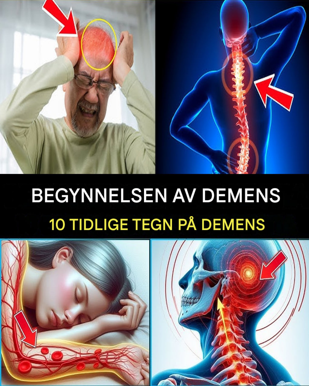 7 TIDLIGE TEGN PÅ ALZHEIMERS SYKDOM DU BØR FØLGE MED