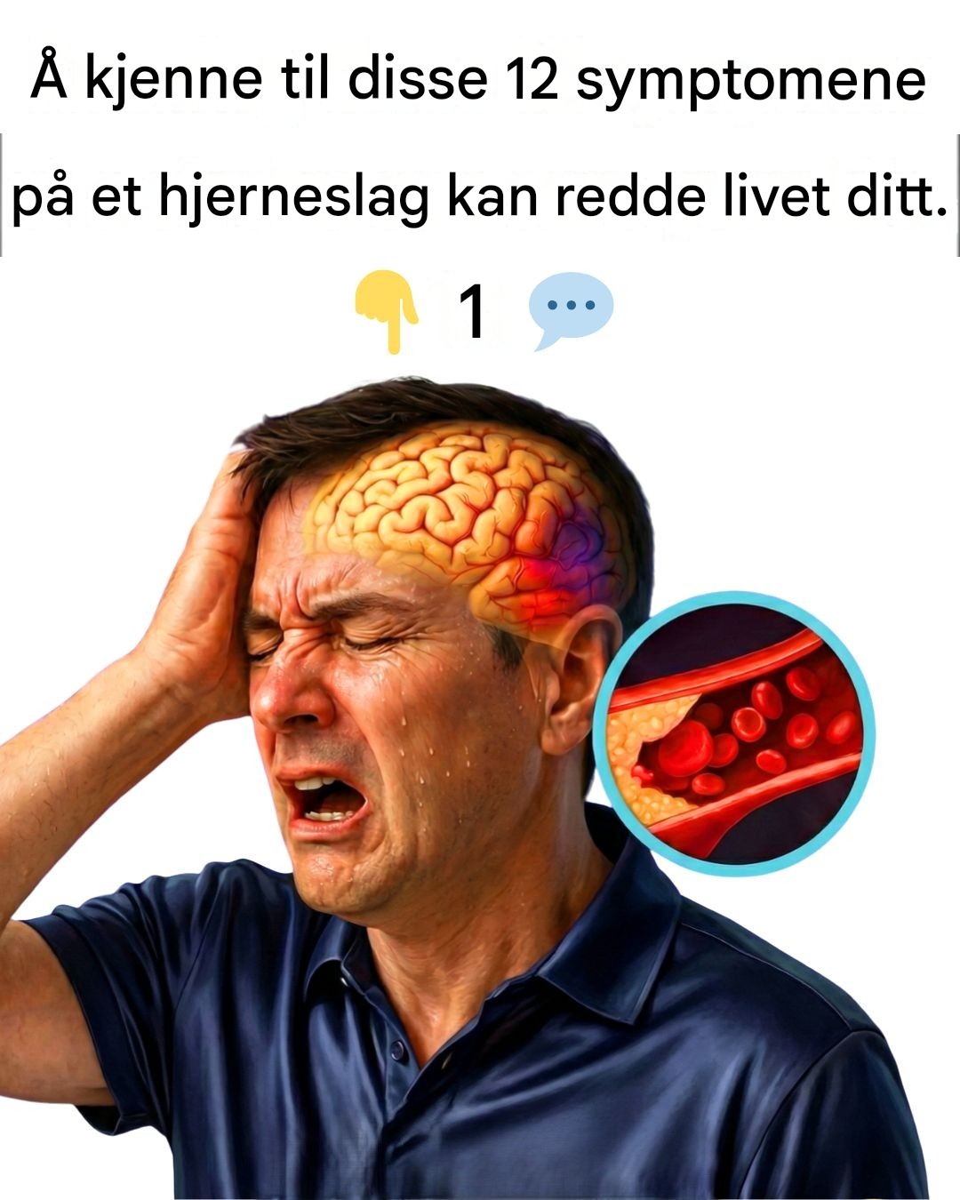Å kjenne disse 12 symptomene på et hjerneslag kan redde livet ditt
