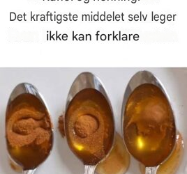 Kanel og honning: Et kraftig naturlig middel