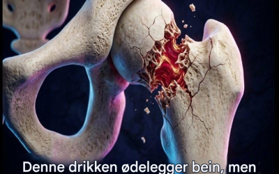 Ifølge helseeksperter er dette de fem drikkene som er mest skadelige for beinene dine.