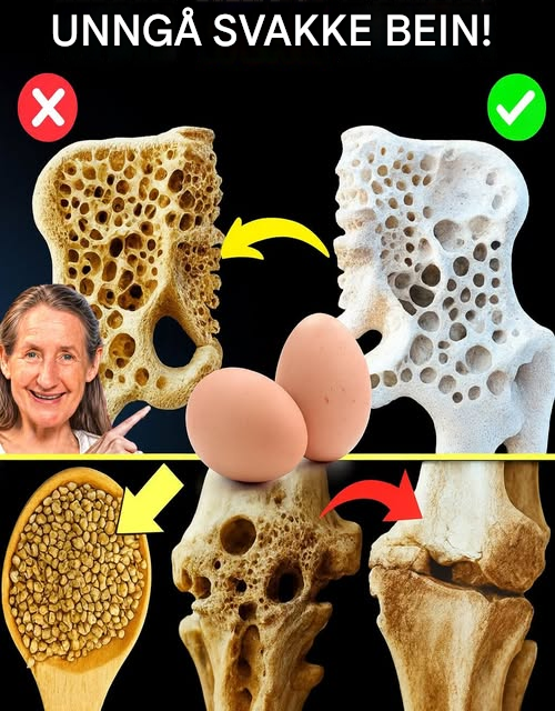 16 toppmatvarer for å styrke beinene dine og bekjempe osteoporose