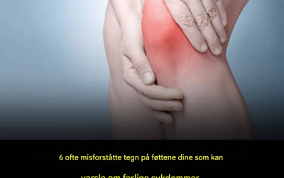 Vær oppmerksom på tegnene på føttene dine