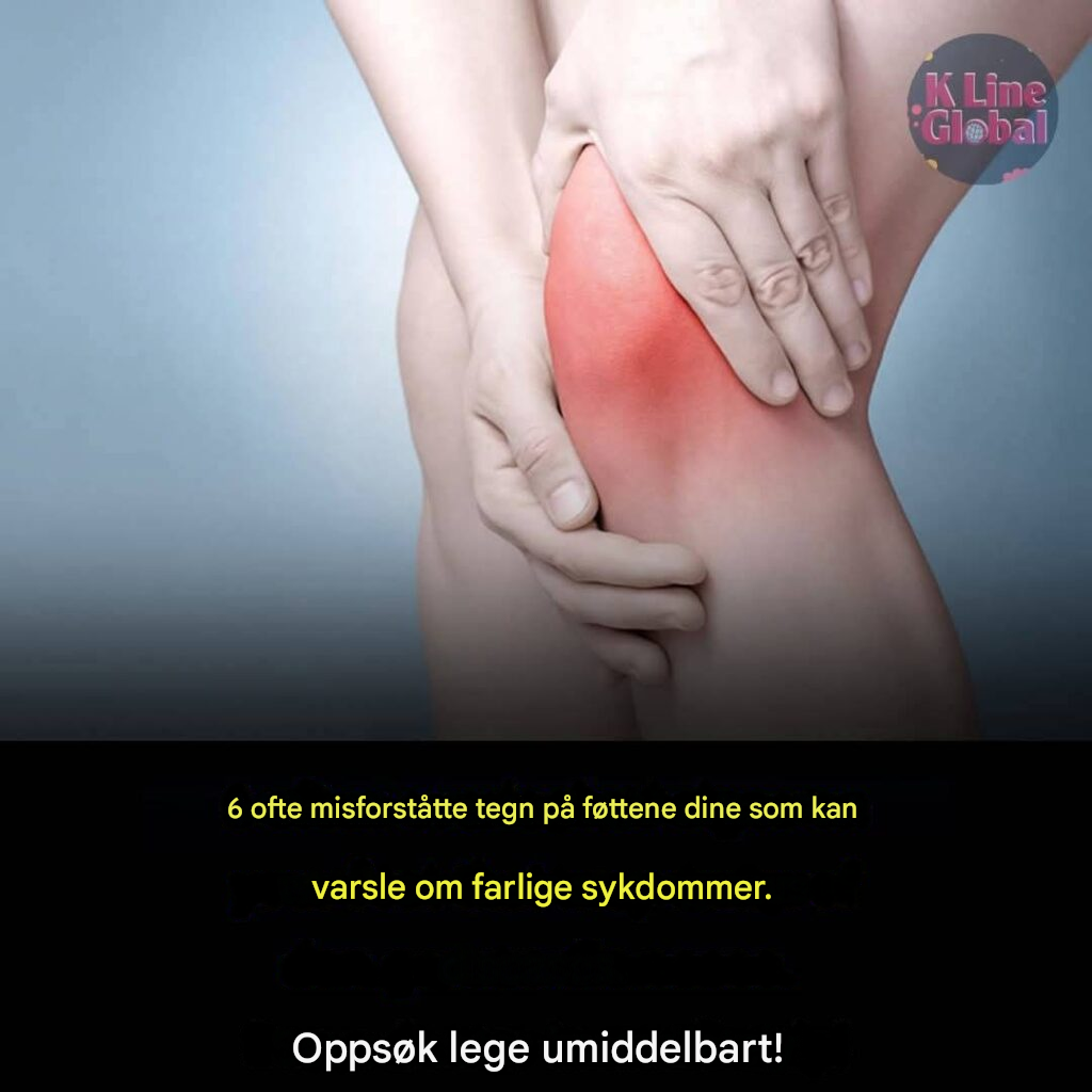 Vær oppmerksom på tegnene på føttene dine