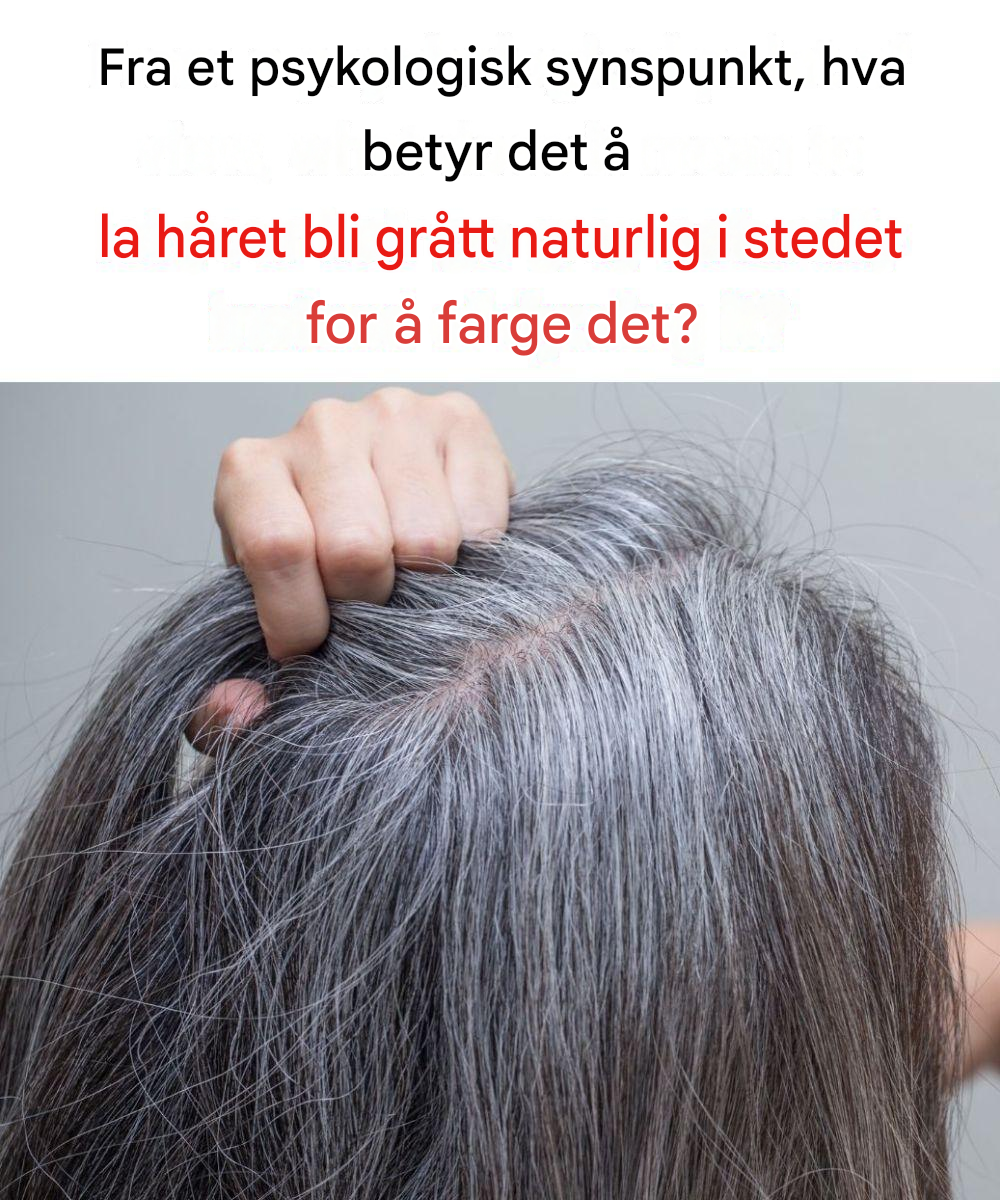 Hvorfor det å bli grå fortsatt gjør noen mennesker ukomfortable
