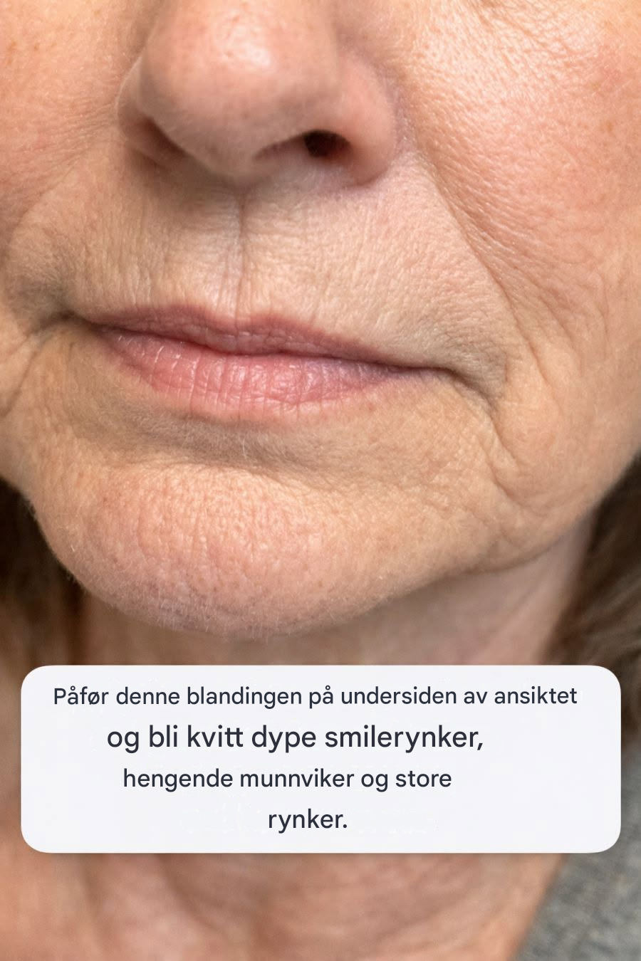 Påfør denne blandingen på undersiden av ansiktet og bli kvitt dype smilerynker, hengende munnviker og store rynker.