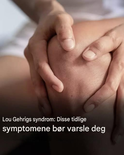 Lou Gehrigs syndrom: Her er de første symptomene på denne sykdommen