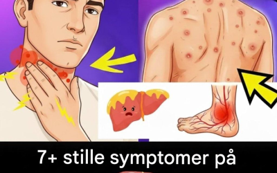 7 «stille» symptomer på fettlever: Hva er ekte og hva er overhypet