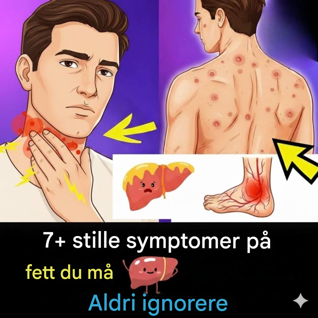 7 «stille» symptomer på fettlever: Hva er ekte og hva er overhypet