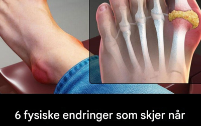 Kroppen din kan vise disse 6 tegnene når hjertehelsen din er i fare