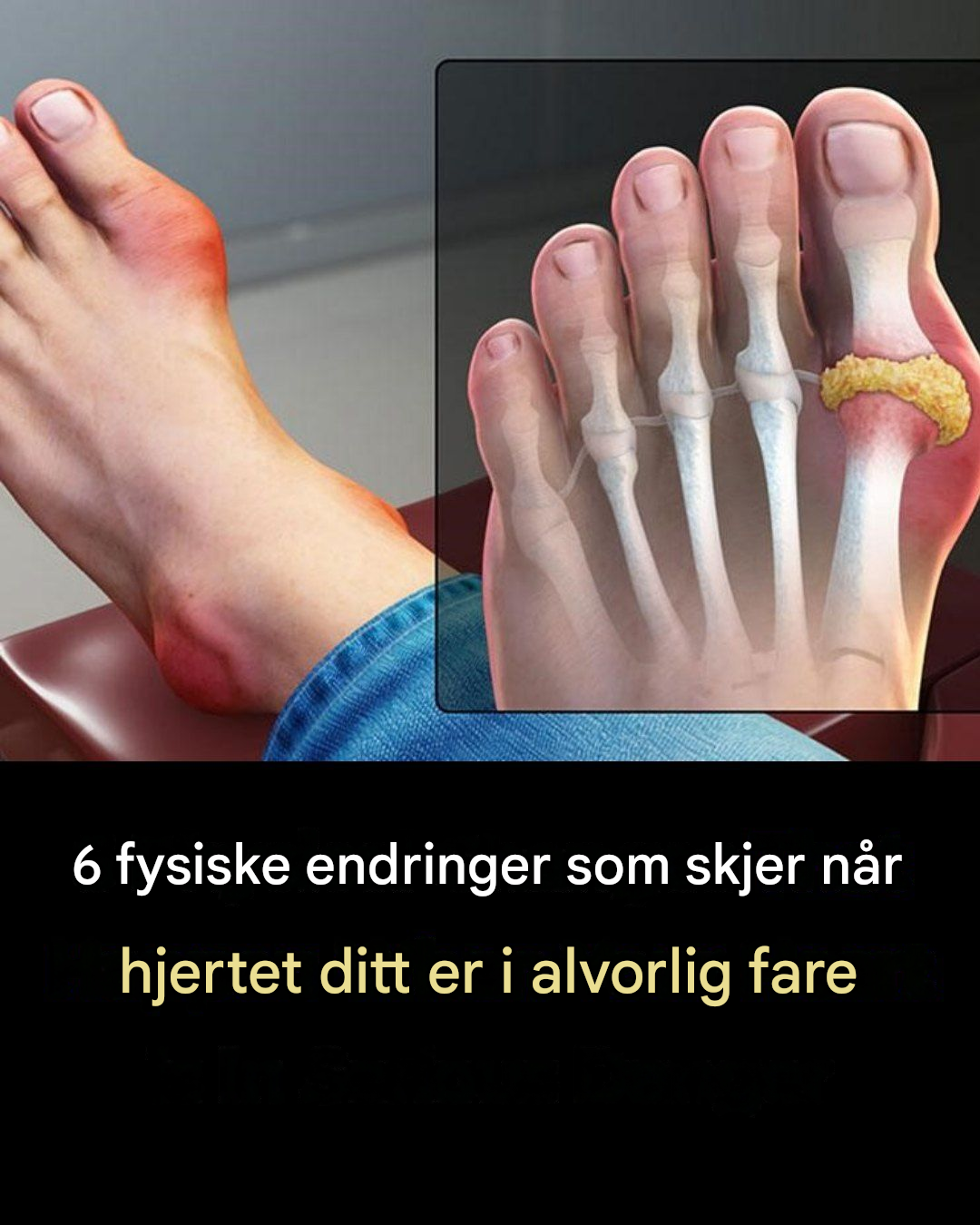 Kroppen din kan vise disse 6 tegnene når hjertehelsen din er i fare