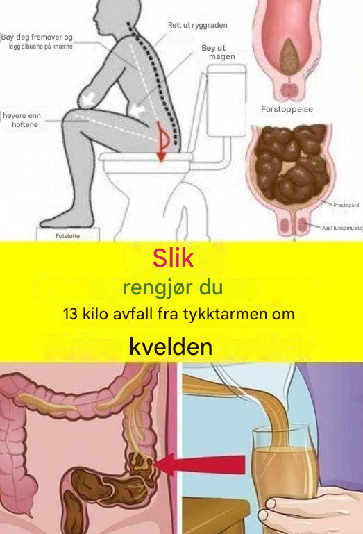 Lær hvordan du fjerner 15 kilo avfall fra tykktarmen på én natt