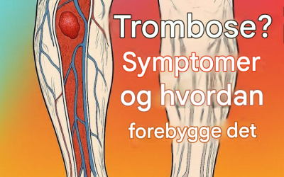 Trombose: Hva det er, hvordan identifisere symptomene og forebygge det naturlig