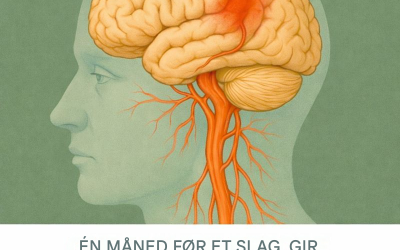 Tidlige varselstegn kroppen din kan gi før et slag