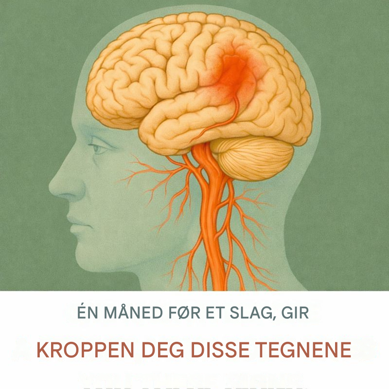Tidlige varselstegn kroppen din kan gi før et slag