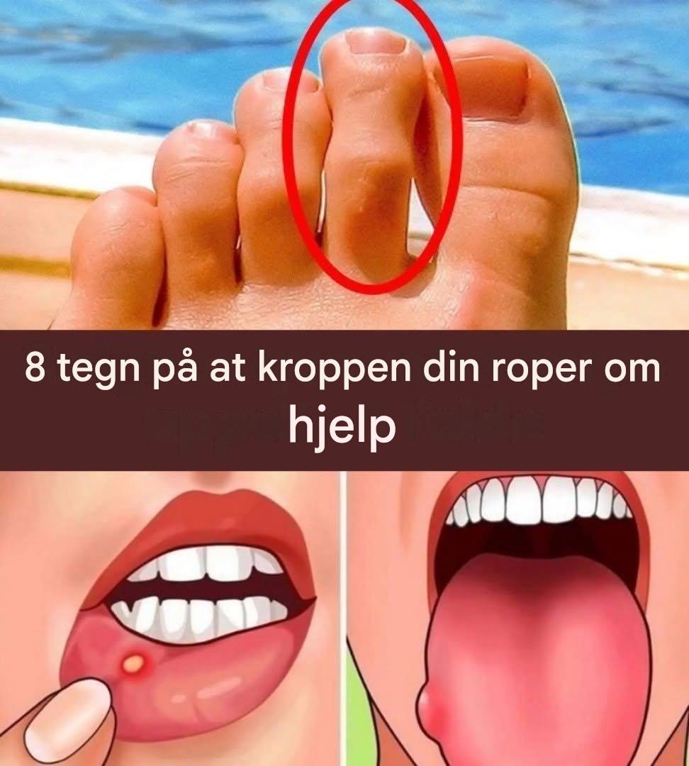 8 tegn på at kroppen din roper om hjelp